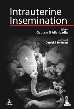 Couverture de l’ouvrage Intrauterine Insemination
