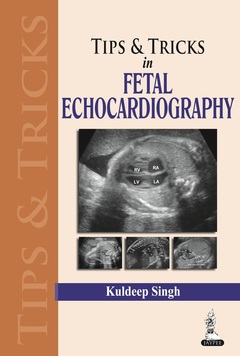 Couverture de l’ouvrage Tips & Tricks in Fetal Echocardiography