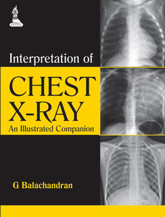 Couverture de l’ouvrage Interpretation of Chest X-Ray