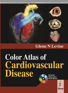Cover of the book Color Atlas of Cardiovascular Disease