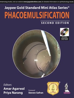 Couverture de l’ouvrage Jaypee Gold Standard Mini Atlas Series: Phacoemulsification