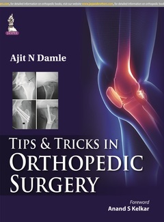 Couverture de l’ouvrage Tips & Tricks in Orthopedic Surgery