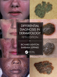 Couverture de l’ouvrage Differential Diagnosis in Dermatology