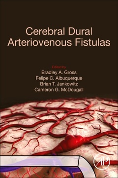 Couverture de l’ouvrage Cerebral Dural Arteriovenous Fistulas