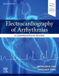 Couverture de l’ouvrage Electrocardiography of Arrhythmias: A Comprehensive Review