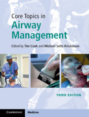 Cover of the book Core Topics in Airway Management
