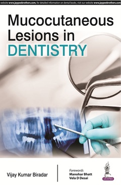 Couverture de l’ouvrage Mucocutaneous Lesions in Dentistry
