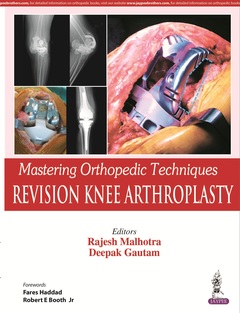 Couverture de l’ouvrage Mastering Orthopedic Techniques: Revision Knee Arthroplasty