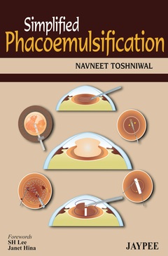 Couverture de l’ouvrage Simplified Phacoemulsification