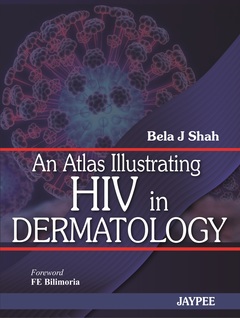 Couverture de l’ouvrage An Atlas Illustrating HIV in Dermatology