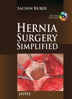 Couverture de l’ouvrage Hernia Surgery Simplified