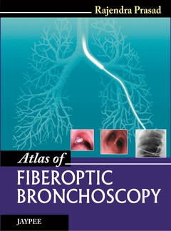 Couverture de l’ouvrage Atlas of Fiberoptic Bronchoscopy