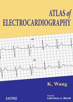 Couverture de l’ouvrage Atlas of Electrocardiography