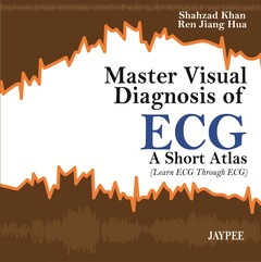 Couverture de l’ouvrage Master Visual Diagnosis of ECG: A Short Atlas (Learn ECG through ECG)