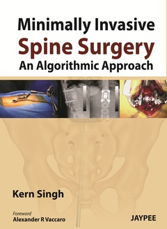 Cover of the book Minimally Invasive Spine Surgery: An Algorithmic Approach