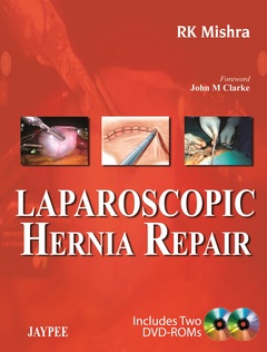 Cover of the book Laparoscopic Hernia Repair