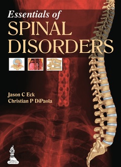 Couverture de l’ouvrage Essentials of Spinal Disorders