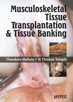Couverture de l’ouvrage Musculoskeletal Tissue Transplantation and Tissue Banking