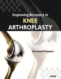 Couverture de l’ouvrage Improving Accuracy in Knee Arthroplasty