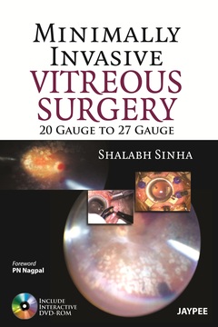 Couverture de l’ouvrage Minimally Invasive Vitreous Surgery: 20 Gauge to 27 Gauge