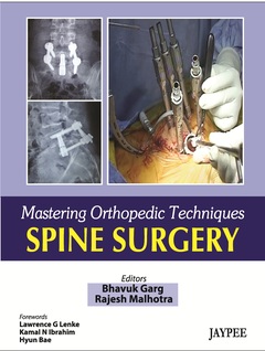 Couverture de l’ouvrage Mastering Orthopaedic Techniques Spine Surgery