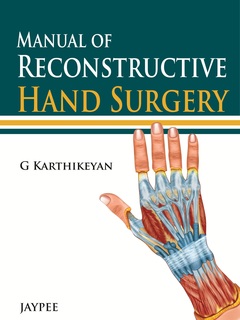 Cover of the book Manual of Reconstructive Hand Surgery