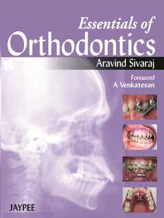 Couverture de l’ouvrage Essentials of Orthodontics