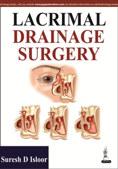 Couverture de l’ouvrage Lacrimal Drainage Surgery
