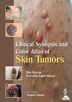 Couverture de l’ouvrage Clinical Synopsis and Color Atlas of Skin Tumors