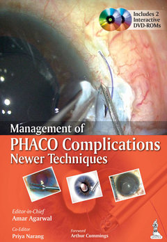 Couverture de l’ouvrage Management of Phaco Complications