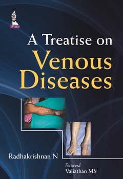 Cover of the book A Treatise on Venous Diseases