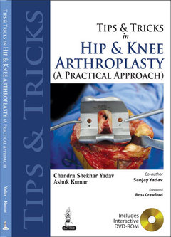 Cover of the book Tips and Tricks in Hip and Knee Arthroplasty