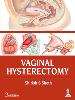 Couverture de l’ouvrage Vaginal Hysterectomy