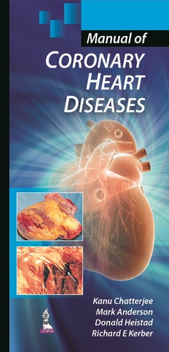 Couverture de l’ouvrage Manual of Coronary Heart Diseases