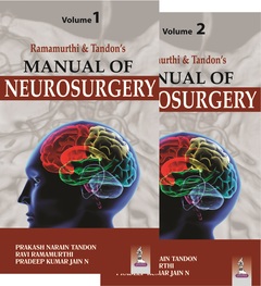 Couverture de l’ouvrage Manual of Neurosurgery - Two Volume Set