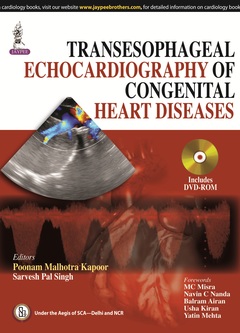 Couverture de l’ouvrage Transesophageal Echocardiography of Congenital Heart Diseases