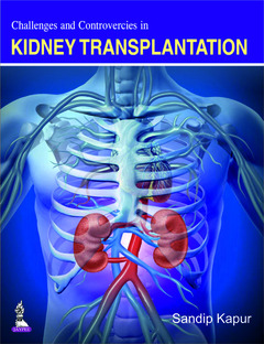 Couverture de l’ouvrage Challenges and Controversies in Kidney Transplantation