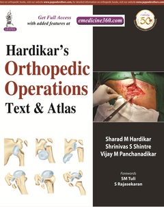 Cover of the book Hardikar's Orthopedic Operations