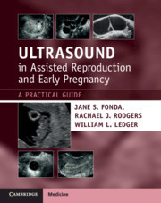 Couverture de l’ouvrage Ultrasound in Assisted Reproduction and Early Pregnancy