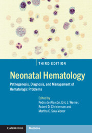 Couverture de l’ouvrage Neonatal Hematology