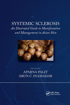 Couverture de l’ouvrage Systemic Sclerosis