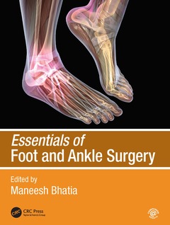 Couverture de l’ouvrage Essentials of Foot and Ankle Surgery