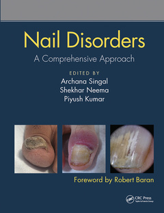 Couverture de l’ouvrage Nail Disorders