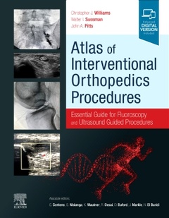 Couverture de l’ouvrage Atlas of Interventional Orthopedics Procedures