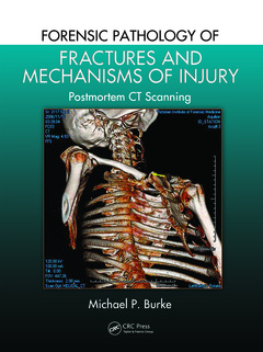 Couverture de l’ouvrage Forensic Pathology of Fractures and Mechanisms of Injury