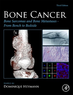 Couverture de l’ouvrage Bone Cancer