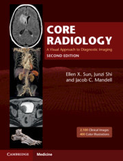 Couverture de l’ouvrage Core Radiology