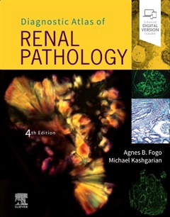 Couverture de l’ouvrage Diagnostic Atlas of Renal Pathology