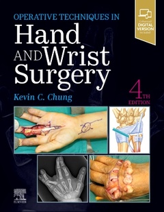 Couverture de l’ouvrage Operative Techniques: Hand and Wrist Surgery