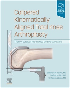 Couverture de l’ouvrage Calipered Kinematically aligned Total Knee Arthroplasty